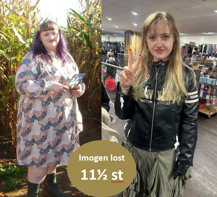 Imogen before and after Imogen before and after