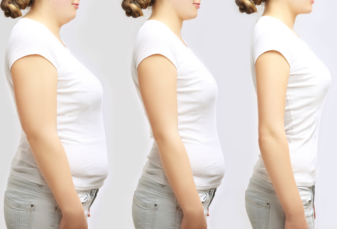 Rapid-and-effective-weight-loss Rapid-and-effective-weight-loss